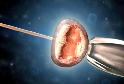 不孕不育发病率40年涨10倍,泰国试管婴儿成主流