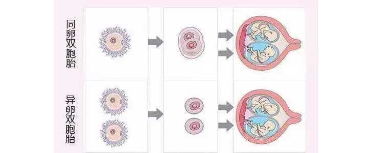 同卵双胞胎与异卵双胞胎