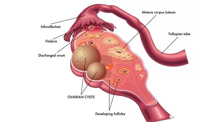 卵巢结构图