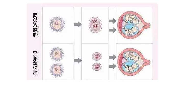 同卵双胞胎与异卵双胞胎
