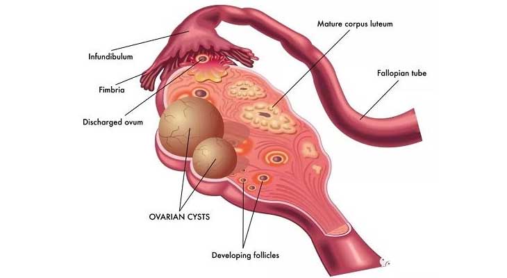 卵巢结构图