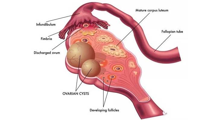 卵巢结构图