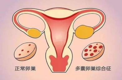 试管婴儿孕产期常见母胎疾病防治方法-E试管-备孕试管婴儿